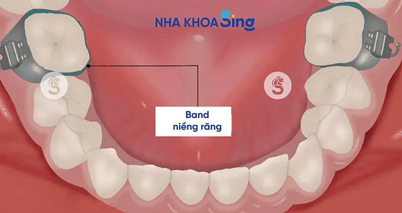 band-nieng-rang-4