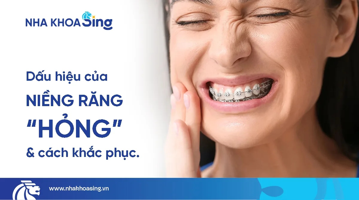 Niềng răng hỏng: Dấu hiệu nhận biết và cách khắc phục an toàn