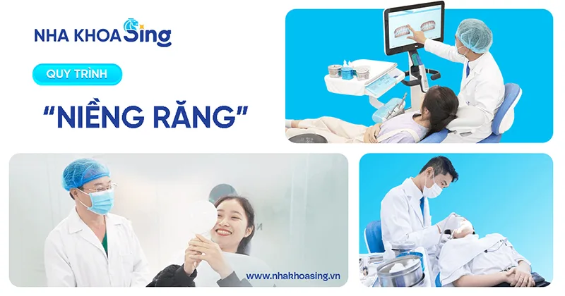 quy-trinh-nieng-rang-3